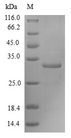 FOXM1 Protein - (Tris-Glycine gel) Discontinuous SDS-PAGE (reduced) with 5% enrichment gel and 15% separation gel.