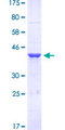 FOXM1 Protein - 12.5% SDS-PAGE Stained with Coomassie Blue.