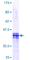 FOXM1 Protein - 12.5% SDS-PAGE Stained with Coomassie Blue.