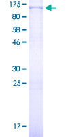 FOXM1 Protein - 12.5% SDS-PAGE of human FOXM1 stained with Coomassie Blue