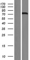 FOXN1 Protein - Western validation with an anti-DDK antibody * L: Control HEK293 lysate R: Over-expression lysate