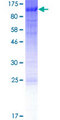 FOXN1 Protein - 12.5% SDS-PAGE of human FOXN1 stained with Coomassie Blue