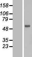 FOXN2 Protein - Western validation with an anti-DDK antibody * L: Control HEK293 lysate R: Over-expression lysate