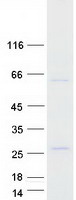 FOXN2 Protein - Purified recombinant protein FOXN2 was analyzed by SDS-PAGE gel and Coomassie Blue Staining