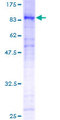 FOXN3 / CHES1 Protein - 12.5% SDS-PAGE of human CHES1 stained with Coomassie Blue