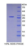FOXO1 / FKHR Protein - Recombinant Forkhead Box Protein O1 By SDS-PAGE