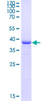 FOXO1 / FKHR Protein - 12.5% SDS-PAGE Stained with Coomassie Blue.