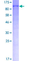 FOXO3 / FOXO3A Protein - 12.5% SDS-PAGE of human FOXO3 stained with Coomassie Blue