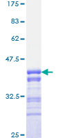 FOXO3 / FOXO3A Protein - 12.5% SDS-PAGE Stained with Coomassie Blue.