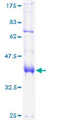 FOXP1 Protein - 12.5% SDS-PAGE of human FOXP1 stained with Coomassie Blue