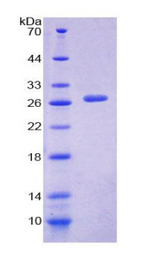 FOXP1 Protein - Recombinant Forkhead Box Protein P1 By SDS-PAGE