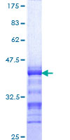FOXP2 Protein - 12.5% SDS-PAGE Stained with Coomassie Blue.