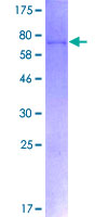 FOXP3 Protein - 12.5% SDS-PAGE of human FOXP3 stained with Coomassie Blue