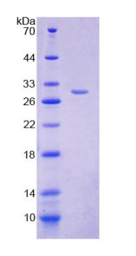 FOXP3 Protein - Recombinant  Forkhead Box Protein P3 By SDS-PAGE