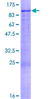 FOXP4 Protein - 12.5% SDS-PAGE of human FOXP4 stained with Coomassie Blue