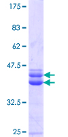 FOXP4 Protein - 12.5% SDS-PAGE Stained with Coomassie Blue.