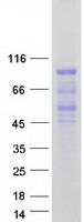 FOXP4 Protein - Purified recombinant protein FOXP4 was analyzed by SDS-PAGE gel and Coomassie Blue Staining