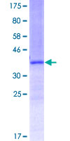 FOXQ1 Protein - 12.5% SDS-PAGE Stained with Coomassie Blue.