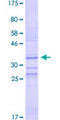 FOXQ1 Protein - 12.5% SDS-PAGE Stained with Coomassie Blue.