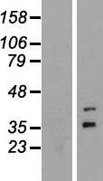 FOXR1 Protein - Western validation with an anti-DDK antibody * L: Control HEK293 lysate R: Over-expression lysate