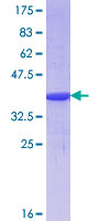 FOXR1 Protein - 12.5% SDS-PAGE Stained with Coomassie Blue.