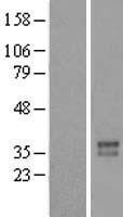 FOXR2 Protein - Western validation with an anti-DDK antibody * L: Control HEK293 lysate R: Over-expression lysate