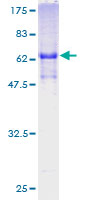 FOXR2 Protein - 12.5% SDS-PAGE of human FOXR2 stained with Coomassie Blue