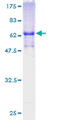 FOXR2 Protein - 12.5% SDS-PAGE of human FOXR2 stained with Coomassie Blue