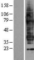 FP / PTGFR Protein - Western validation with an anti-DDK antibody * L: Control HEK293 lysate R: Over-expression lysate