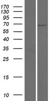 FPGT Protein - Western validation with an anti-DDK antibody * L: Control HEK293 lysate R: Over-expression lysate