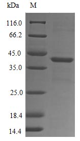 FPR1 / FPR Protein - (Tris-Glycine gel) Discontinuous SDS-PAGE (reduced) with 5% enrichment gel and 15% separation gel.