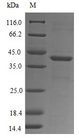 FPR1 / FPR Protein - (Tris-Glycine gel) Discontinuous SDS-PAGE (reduced) with 5% enrichment gel and 15% separation gel.
