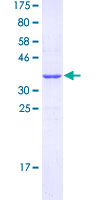 FPR1 / FPR Protein - 12.5% SDS-PAGE Stained with Coomassie Blue.