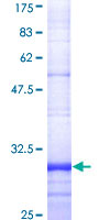 FPR2 / FPRL1 Protein - 12.5% SDS-PAGE Stained with Coomassie Blue.