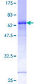 FRA-1 / FOSL1 Protein - 12.5% SDS-PAGE of human FOSL1 stained with Coomassie Blue
