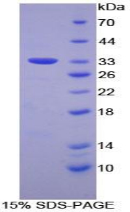 FRA-1 / FOSL1 Protein - Recombinant FOS Like Antigen 1 By SDS-PAGE