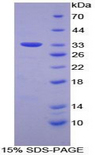 FRA-1 / FOSL1 Protein - Recombinant FOS Like Antigen 1 By SDS-PAGE