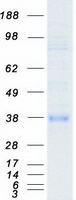 FRA-1 / FOSL1 Protein - Purified recombinant protein FOSL1 was analyzed by SDS-PAGE gel and Coomassie Blue Staining