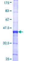 FRA10AC1 Protein - 12.5% SDS-PAGE Stained with Coomassie Blue.