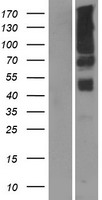 FRA9F Protein - Western validation with an anti-DDK antibody * L: Control HEK293 lysate R: Over-expression lysate