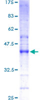 Fragilis / IFITM3 Protein - 12.5% SDS-PAGE of human IFITM3 stained with Coomassie Blue