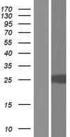 FRAT2 Protein - Western validation with an anti-DDK antibody * L: Control HEK293 lysate R: Over-expression lysate