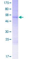 FRAT2 Protein - 12.5% SDS-PAGE of human FRAT2 stained with Coomassie Blue