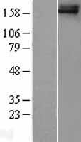 FREM1 Protein - Western validation with an anti-DDK antibody * L: Control HEK293 lysate R: Over-expression lysate