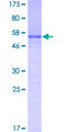 FRG1 Protein - 12.5% SDS-PAGE of human FRG1 stained with Coomassie Blue