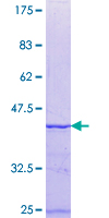 FRG1 Protein - 12.5% SDS-PAGE Stained with Coomassie Blue.