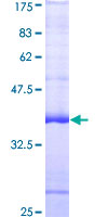 FRK Protein - 12.5% SDS-PAGE Stained with Coomassie Blue.