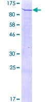 FRMD3 Protein - 12.5% SDS-PAGE of human FRMD3 stained with Coomassie Blue