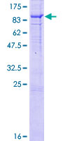 FRMD5 Protein - 12.5% SDS-PAGE of human FRMD5 stained with Coomassie Blue