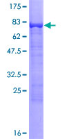 FRMD8 Protein - 12.5% SDS-PAGE of human FKSG44 stained with Coomassie Blue